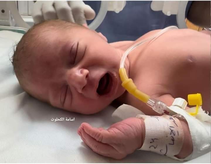 انقاذ حياة جنين من رحم والدته