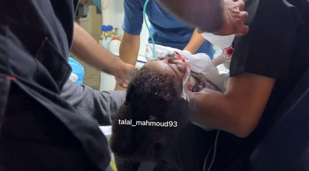 جرحى واصابات نتيجة قصف اسرائيلي لمنزل في مخيم النصيرات
