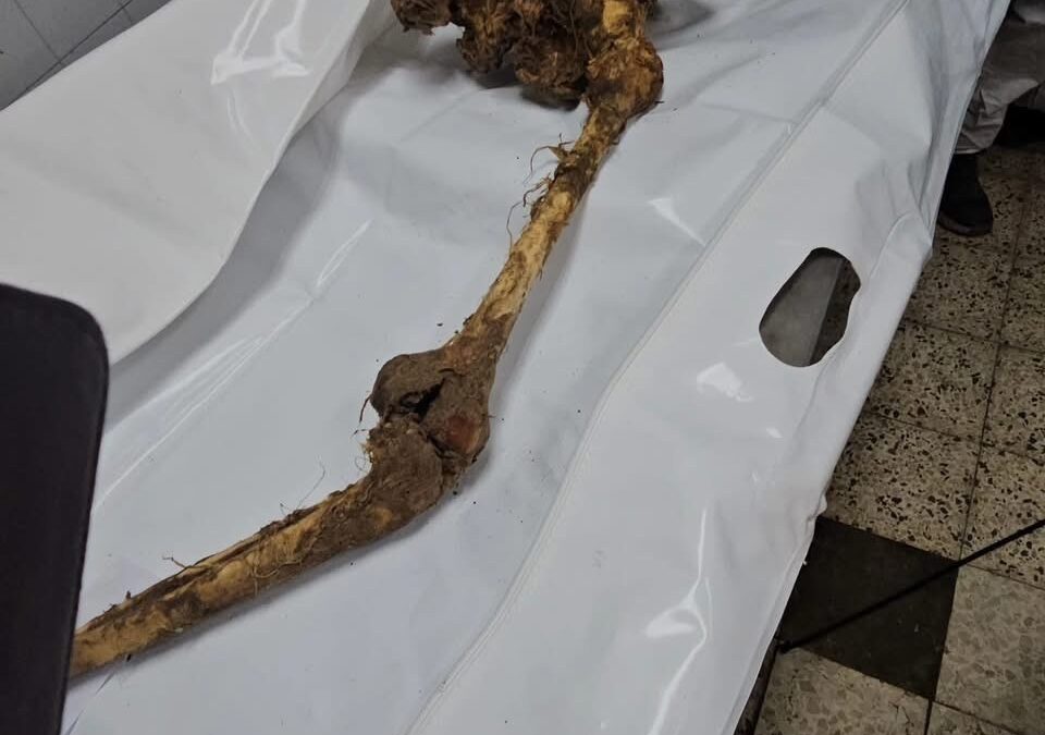 الصحة بغزة تخصص آلية للتعرف على رفات 15 شهيدا سلمها الاحتلال 06 فبراير 2026 . الس