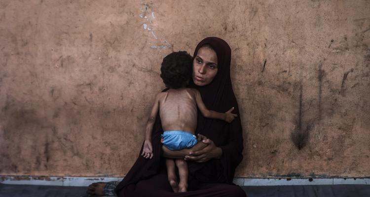 أطفال غزة يُقتلون بـ”الشوكولاتة”.. تتصاعد حالات سوء التغذية ضمن سياسة هندسة التجويع