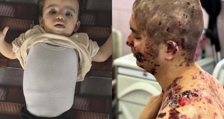 تقرير قلب “غزل” وجسد “عبد الله”.. ضحايا حصار الاحتلال لفرص الحياة في غزة
