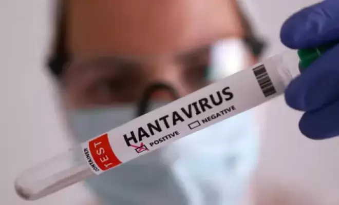 فرنسا تُسجّل أول إصابة بفيروس هانتا