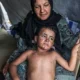 أبو سلمية: 5 آلاف إصابة جلدية أسبوعياً ووفيات يومية لمرضى السرطان بمجمع الشفاء