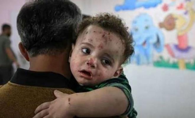 5000 إصابة أسبوعيًا: تحذيرات من اتساع رقعة “جدري الماء” في قطاع غزة