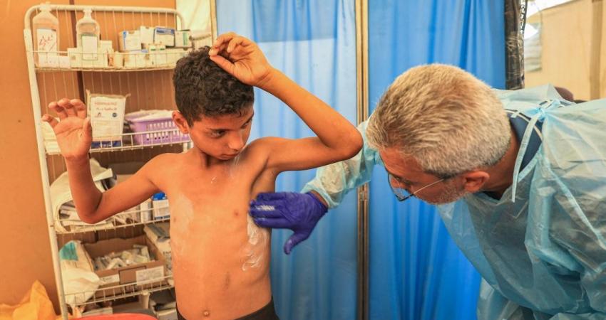 الأمم المتحدة تُحذر من تفشٍ واسع لـ “جدري الماء” يُهدد النازحين في غزة