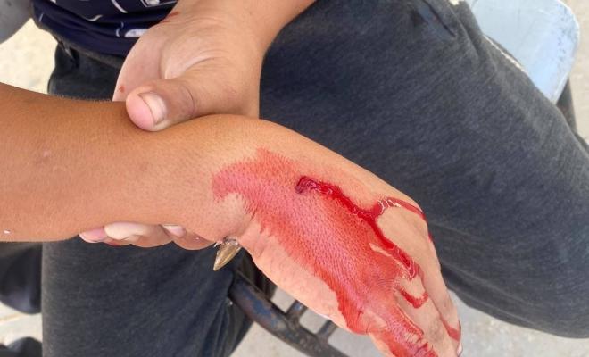 التعليم بغزة: إصابة طالب بنيران الاحتلال داخل مدرسته غرب المدينة