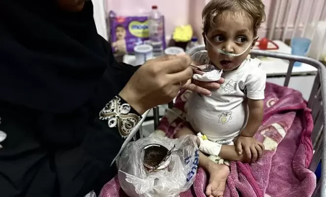 التقزّم والهزال يهدّدان أطفال غزة