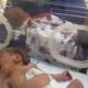 طبيب بمجمع ناصر: انقطاع الأكسجين يهدد حياة الأطفال الخدج