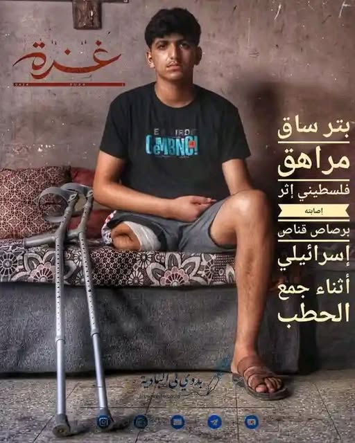 بتر ساق مراهق فلسطيني إثر إصابته برصاص قناص إسرائيلي أثناء جمع الحطب